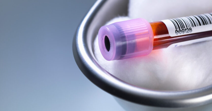 premiera medicala in sua un robot va putea recolta singur sange de la pacienti cum functioneaza noua tehnologie 6a8abb4a979f6