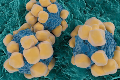 un ingredient activ din viagra ar putea limita raspandirea cancerului studiu 6a718810e5060