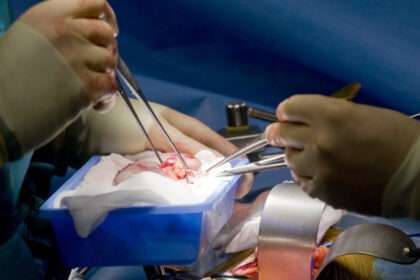 record medical un rinichi de porc transplantat a functionat in corpul unui pacient din sua timp de 271 de zile 6a9a9ecf53497