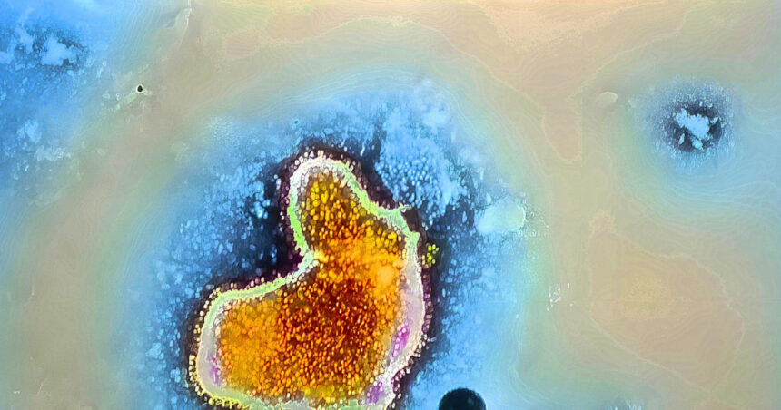 mexic amiba mancatoare de creier a fost detectata in yucatan sase lacuri au fost inchise autoritatile in alerta 6ad1400731eb8