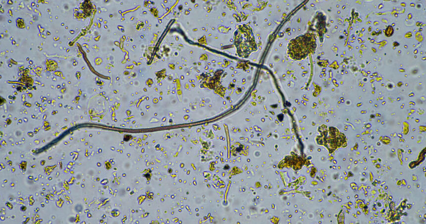 o ciuperca rara care ataca creierul se raspandeste in sua infectia poate ucide pana la 70 dintre pacienti 6ad37d1002a90
